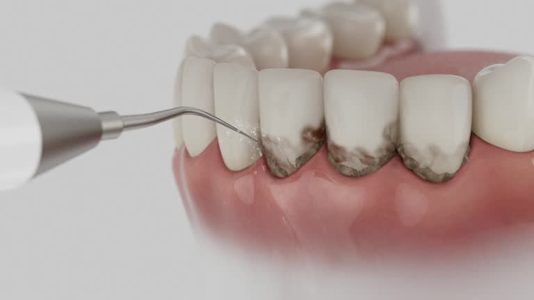 Reliable Dental Implants contractor in Campbelltown, PA by Smile Center Dentistry